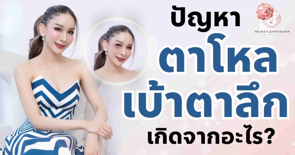 ปัญหา ตาโหล เบ้าตาลึก เกิดจากอะไร ? พร้อมวิธีแก้ไขในปี 2024