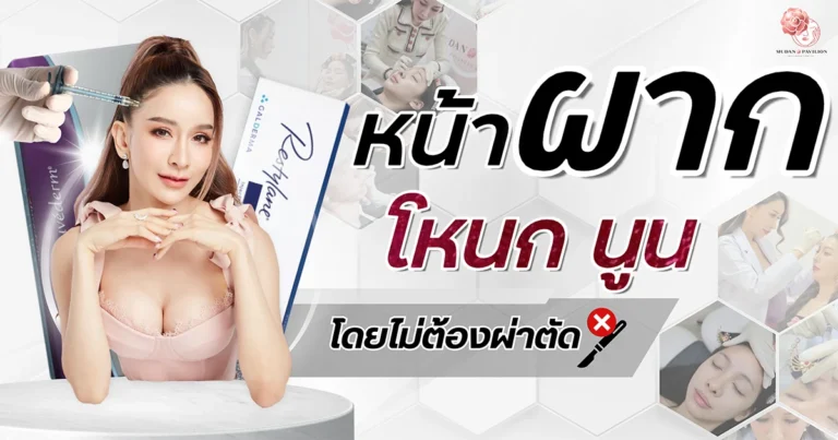 Web cover with a prominent forehead