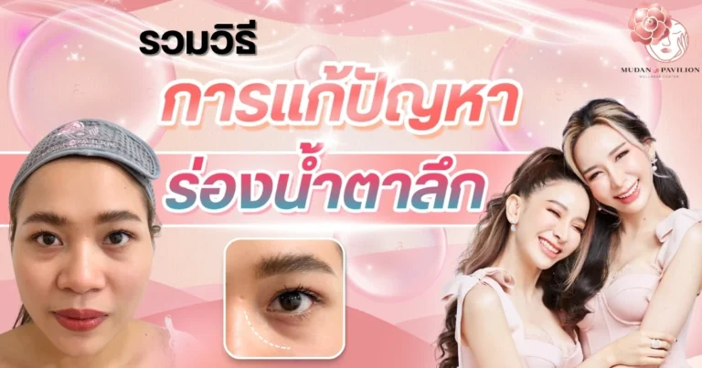 Fixing Deep Tear Troughs Natural and Quick Solutions