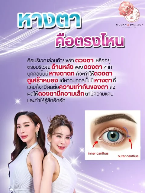 Where is the outer corner of the eye