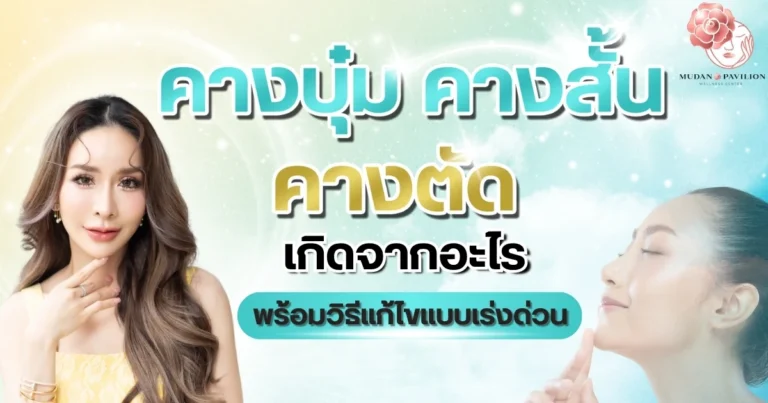 Dimpled chin-short chin_cover