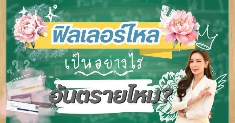 What is filler migration and is it dangerous