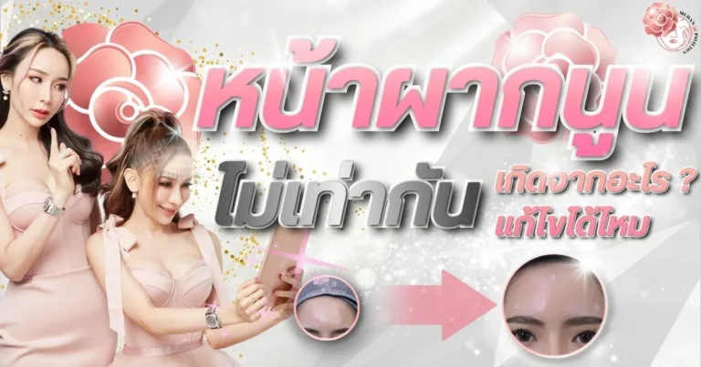 Fixing Uneven Forehead-CoverPage