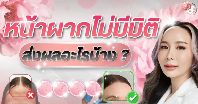 Forehead lacks volume - CoverWeb